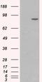 Catenin Alpha 1 antibody, EB07242, Everest Biotech, Western Blot image 