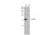 Basic Leucine Zipper ATF-Like Transcription Factor antibody, GTX135928, GeneTex, Western Blot image 