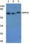 Inositol Polyphosphate-5-Phosphatase J antibody, A10752, Boster Biological Technology, Western Blot image 