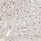 AF4/FMR2 Family Member 4 antibody, NBP1-89220, Novus Biologicals, Immunohistochemistry frozen image 