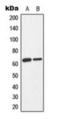 Protein Kinase AMP-Activated Catalytic Subunit Alpha 1 antibody, orb224175, Biorbyt, Western Blot image 
