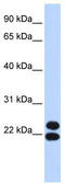 Paired Related Homeobox 2 antibody, TA345200, Origene, Western Blot image 