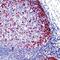 Insulin Like Growth Factor 2 antibody, MA5-12252, Invitrogen Antibodies, Immunohistochemistry paraffin image 