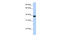 Ankyrin Repeat And SOCS Box Containing 5 antibody, 26-505, ProSci, Western Blot image 