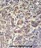 Sosondowah Ankyrin Repeat Domain Family Member C antibody, abx032620, Abbexa, Immunohistochemistry frozen image 