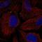 Transmembrane Protein 198 antibody, HPA042385, Atlas Antibodies, Immunofluorescence image 