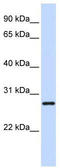 TGFB Induced Factor Homeobox 2 Like X-Linked antibody, TA341451, Origene, Western Blot image 
