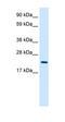 MYCL Proto-Oncogene, BHLH Transcription Factor antibody, orb324619, Biorbyt, Western Blot image 