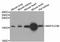 Microtubule Associated Protein 1 Light Chain 3 Beta antibody, A11280, ABclonal Technology, Western Blot image 