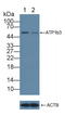 ATPase Na+/K+ Transporting Subunit Beta 3 antibody, LS-C292955, Lifespan Biosciences, Western Blot image 