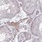 Zinc Finger And SCAN Domain Containing 9 antibody, PA5-63801, Invitrogen Antibodies, Immunohistochemistry paraffin image 