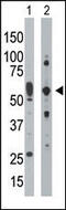 Eukaryotic Translation Initiation Factor 2 Alpha Kinase 2 antibody, MBS9208589, MyBioSource, Western Blot image 