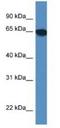 Scavenger Receptor Class A Member 3 antibody, NBP1-79201, Novus Biologicals, Western Blot image 