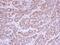 Acylglycerol Kinase antibody, NBP1-32163, Novus Biologicals, Immunohistochemistry paraffin image 