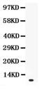 Prolactin antibody, PA5-79874, Invitrogen Antibodies, Western Blot image 