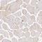 Histone Deacetylase 1 antibody, HPA029693, Atlas Antibodies, Immunohistochemistry paraffin image 