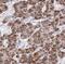 NADH:Ubiquinone Oxidoreductase Core Subunit S1 antibody, FNab05629, FineTest, Immunohistochemistry paraffin image 