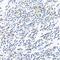Major Histocompatibility Complex, Class II, DR Beta 3 antibody, GTX54087, GeneTex, Immunohistochemistry paraffin image 