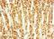 Activin A Receptor Type 1C antibody, LS-C379082, Lifespan Biosciences, Immunohistochemistry paraffin image 