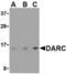 Atypical Chemokine Receptor 1 (Duffy Blood Group) antibody, AHP1708, Bio-Rad (formerly AbD Serotec) , Immunohistochemistry paraffin image 