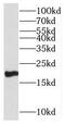 Homeobox protein MIXL1 antibody, FNab05200, FineTest, Western Blot image 