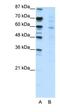 CBFA2/RUNX1 Partner Transcriptional Co-Repressor 3 antibody, orb324761, Biorbyt, Western Blot image 
