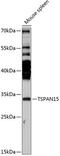 Tetraspanin 15 antibody, 15-520, ProSci, Western Blot image 