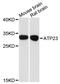 ATP23 Metallopeptidase And ATP Synthase Assembly Factor Homolog antibody, A13990, Boster Biological Technology, Western Blot image 