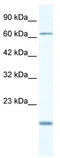 T-Box 5 antibody, TA334174, Origene, Western Blot image 