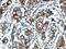 Secreted Phosphoprotein 1 antibody, 25715-1-AP, Proteintech Group, Immunohistochemistry paraffin image 