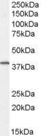 FXYD Domain Containing Ion Transport Regulator 5 antibody, PA5-18020, Invitrogen Antibodies, Western Blot image 