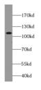 Complement C3 antibody, FNab01103, FineTest, Western Blot image 