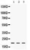 Cofilin 2 antibody, PA5-79037, Invitrogen Antibodies, Western Blot image 