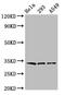 Golgi Phosphoprotein 3 antibody, CSB-PA872494LA01HU, Cusabio, Western Blot image 