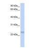 Serine And Arginine Rich Splicing Factor 3 antibody, NBP1-57242, Novus Biologicals, Western Blot image 