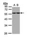 Keratin 8 antibody, GTX109489, GeneTex, Western Blot image 