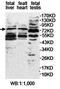 EF-Hand Calcium Binding Domain 7 antibody, orb78253, Biorbyt, Western Blot image 