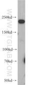 Sodium Voltage-Gated Channel Alpha Subunit 9 antibody, 20257-1-AP, Proteintech Group, Western Blot image 