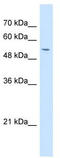 Glycoprotein Nmb antibody, TA335818, Origene, Western Blot image 