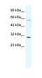 GATA Zinc Finger Domain Containing 1 antibody, orb324462, Biorbyt, Western Blot image 