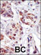 Phosphatidylinositol-4-Phosphate 5-Kinase Type 1 Gamma antibody, 63-363, ProSci, Immunohistochemistry paraffin image 