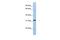 Solute Carrier Family 25 Member 28 antibody, PA5-42498, Invitrogen Antibodies, Western Blot image 