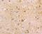 Hypoxanthine Phosphoribosyltransferase 1 antibody, NBP2-75528, Novus Biologicals, Immunohistochemistry paraffin image 