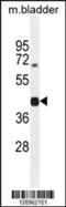 SH2 Domain Containing 5 antibody, 55-687, ProSci, Western Blot image 