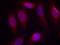 Mitogen-Activated Protein Kinase Kinase 4 antibody, GTX50227, GeneTex, Immunocytochemistry image 