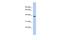 Fat Storage Inducing Transmembrane Protein 1 antibody, A14952, Boster Biological Technology, Western Blot image 