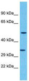 Olfactory Receptor Family 2 Subfamily F Member 2 antibody, TA337490, Origene, Western Blot image 
