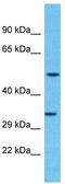 Olfactory Receptor Family 2 Subfamily F Member 2 antibody, TA337490, Origene, Western Blot image 