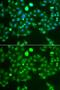 VPS37A Subunit Of ESCRT-I antibody, orb373808, Biorbyt, Immunofluorescence image 