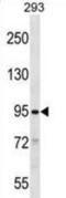 SLIT And NTRK Like Family Member 2 antibody, abx028903, Abbexa, Western Blot image 